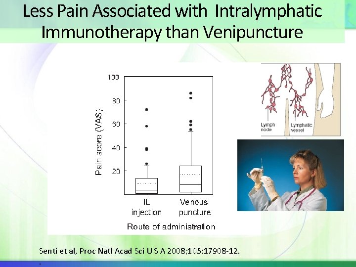 Less Pain Associated with Intralymphatic Immunotherapy than Venipuncture Senti et al, Proc Natl Acad