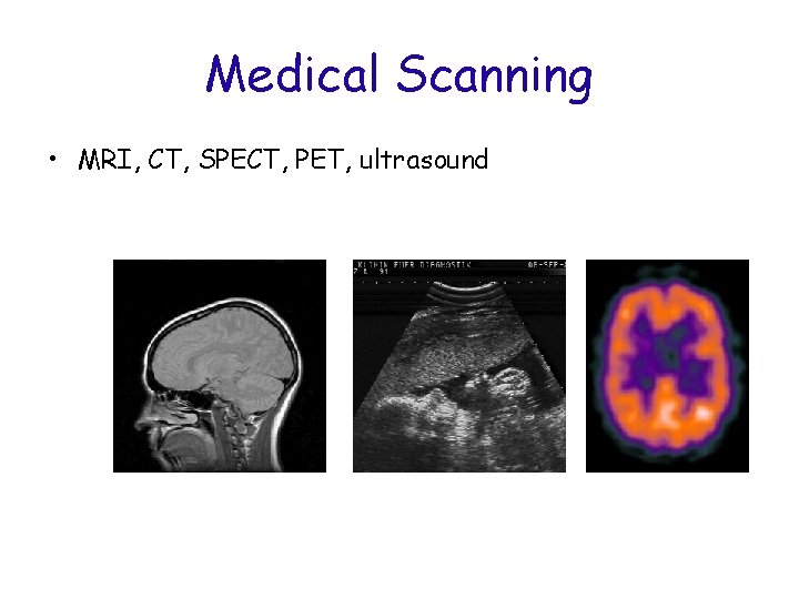 Medical Scanning • MRI, CT, SPECT, PET, ultrasound 