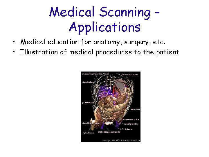 Medical Scanning Applications • Medical education for anatomy, surgery, etc. • Illustration of medical