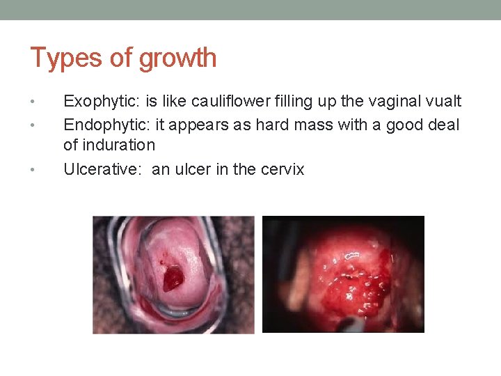 Types of growth • • • Exophytic: is like cauliflower filling up the vaginal