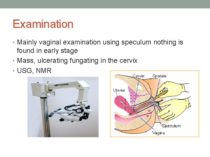 Examination • Mainly vaginal examination using speculum nothing is found in early stage •