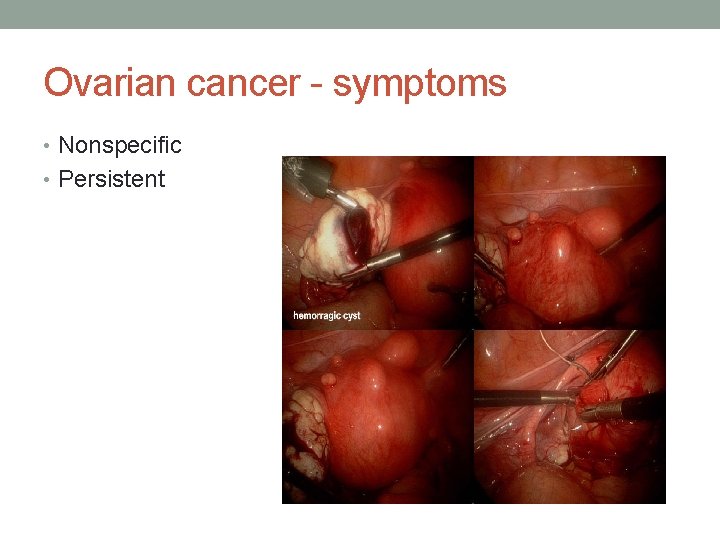 Ovarian cancer - symptoms • Nonspecific • Persistent 