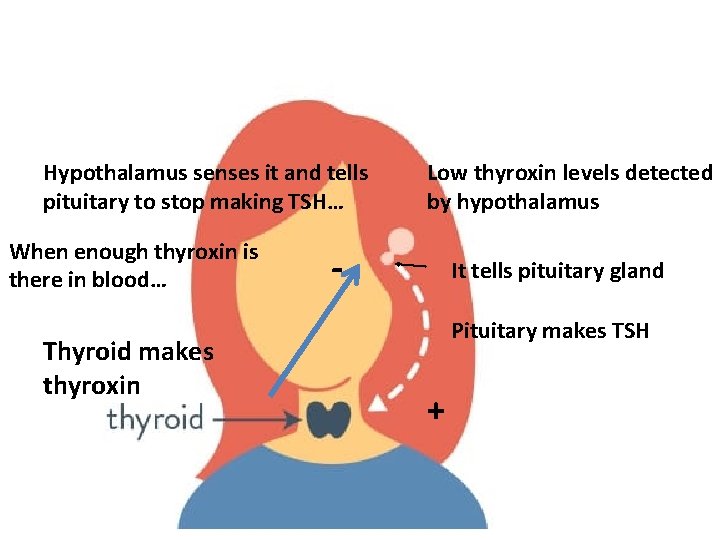 Hypothalamus senses it and tells pituitary to stop making TSH… When enough thyroxin is