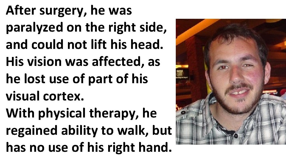 After surgery, he was paralyzed on the right side, and could not lift his