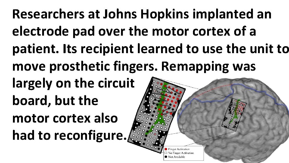 Researchers at Johns Hopkins implanted an electrode pad over the motor cortex of a