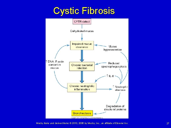 Cystic Fibrosis Mosby items and derived items © 2010, 2006 by Mosby, Inc. , Cystic Fibrosis Mosby items and derived items © 2010, 2006 by Mosby, Inc. ,