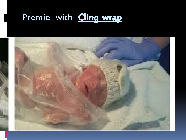 Premie with Cling wrap 