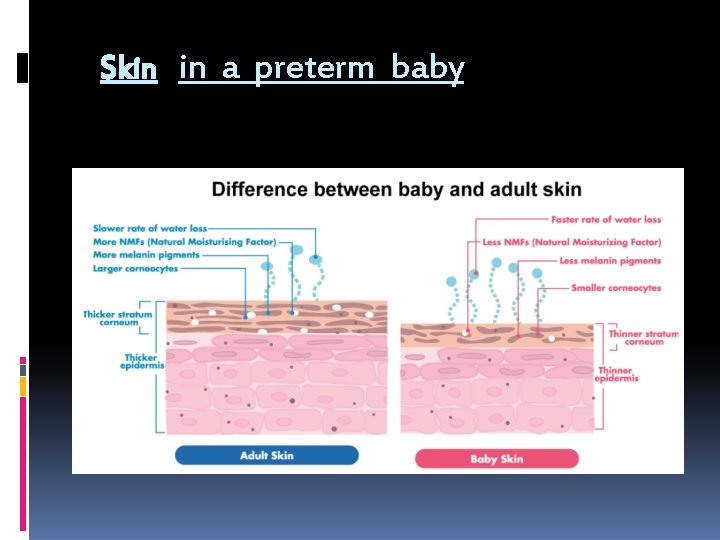 Skin in a preterm baby 