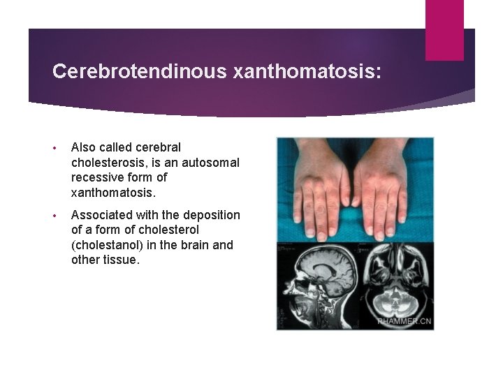 Cerebrotendinous xanthomatosis: • Also called cerebral cholesterosis, is an autosomal recessive form of xanthomatosis.