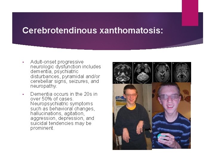 Cerebrotendinous xanthomatosis: • Adult-onset progressive neurologic dysfunction includes dementia, psychiatric disturbances, pyramidal and/or cerebellar