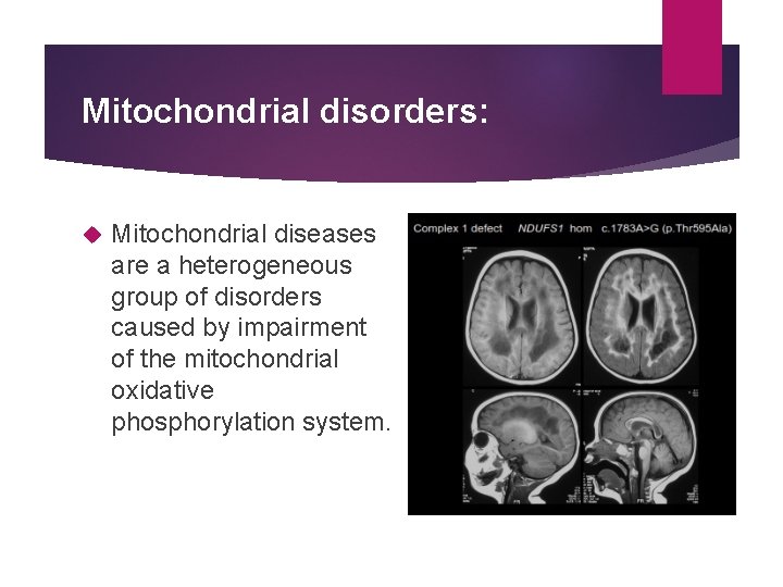 Mitochondrial disorders: Mitochondrial diseases are a heterogeneous group of disorders caused by impairment of