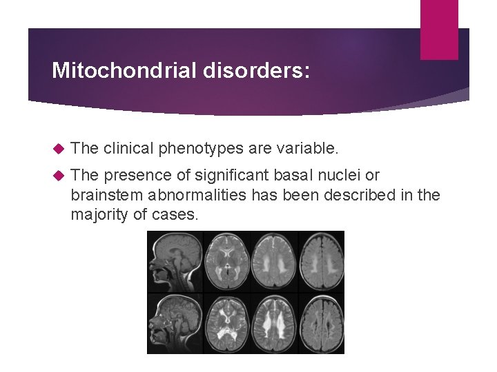 Mitochondrial disorders: The clinical phenotypes are variable. The presence of signiﬁcant basal nuclei or
