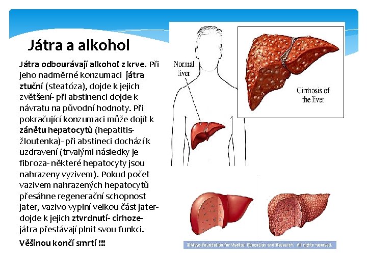 Játra a alkohol Játra odbourávají alkohol z krve. Při jeho nadměrné konzumaci játra ztuční Játra a alkohol Játra odbourávají alkohol z krve. Při jeho nadměrné konzumaci játra ztuční