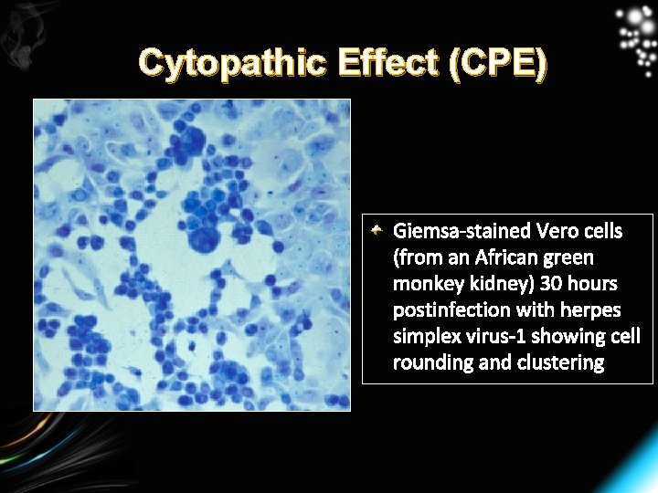 Cytopathic Effect (CPE) Giemsa-stained Vero cells (from an African green monkey kidney) 30 hours