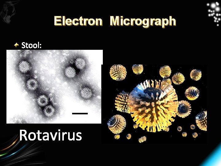 Electron Micrograph Stool: Rotavirus 