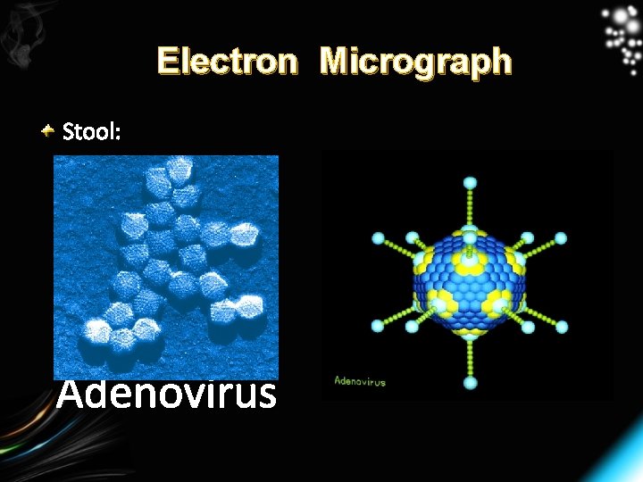 Electron Micrograph Stool: Adenovirus 