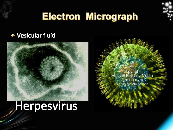 Electron Micrograph Vesicular fluid Herpesvirus 