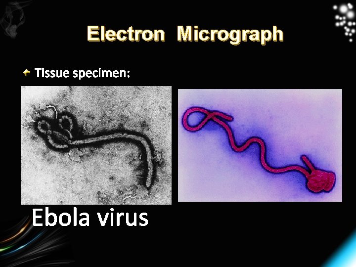 Electron Micrograph Tissue specimen: Ebola virus 