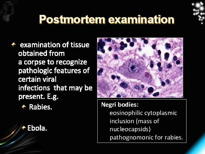 Postmortem examination of tissue obtained from a corpse to recognize pathologic features of certain