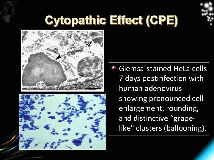 Cytopathic Effect (CPE) Giemsa-stained He. La cells 7 days postinfection with human adenovirus showing