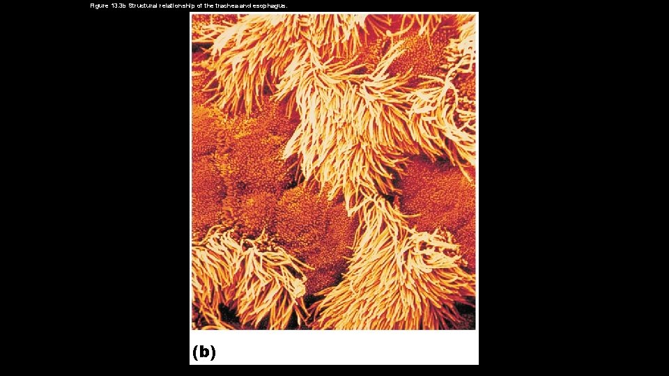 Figure 13. 3 b Structural relationship of the trachea and esophagus. (b) 