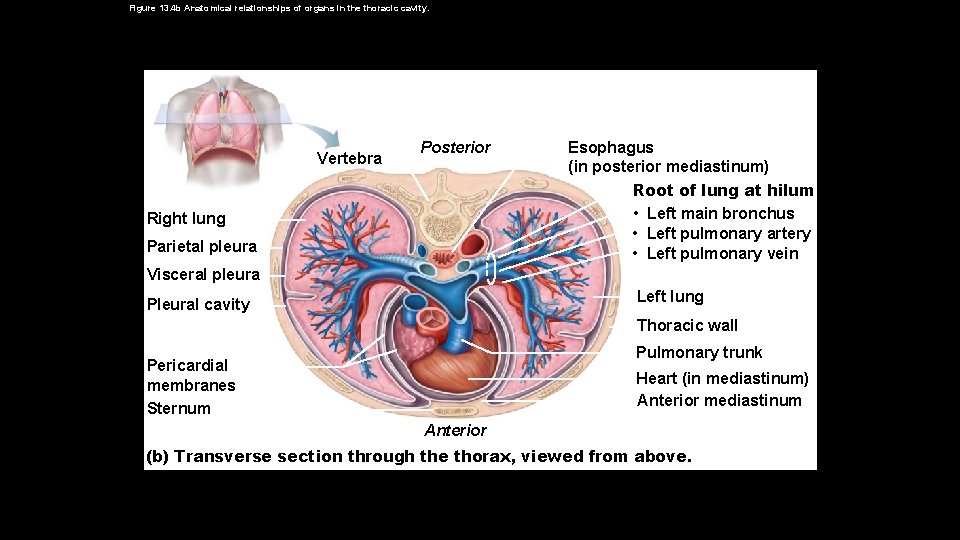 Figure 13. 4 b Anatomical relationships of organs in the thoracic cavity. Vertebra Posterior