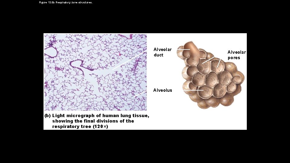 Figure 13. 5 b Respiratory zone structures. Alveolar duct Alveolus (b) Light micrograph of