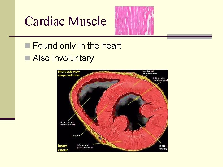 Cardiac Muscle n Found only in the heart n Also involuntary 