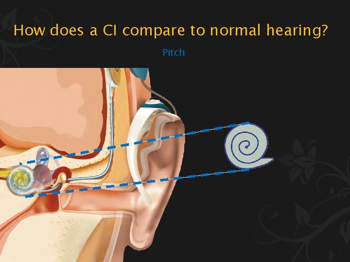 How does a CI compare to normal hearing? Pitch 