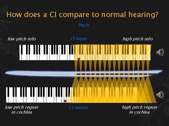 How does a CI compare to normal hearing? Pitch low pitch info CI input