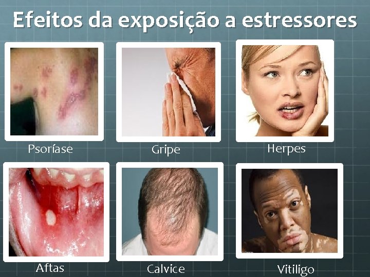 Efeitos da exposição a estressores Psoríase Gripe Aftas Calvice Herpes Vitiligo 