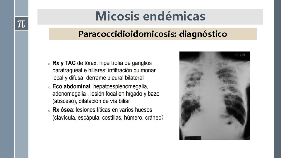 Micosis endémicas Paracoccidioidomicosis: diagnóstico 