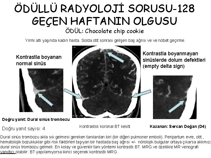 ÖDÜLLÜ RADYOLOJİ SORUSU-128 GEÇEN HAFTANIN OLGUSU ÖDÜL: Chocolate chip cookie Yirmi altı yaşında kadın