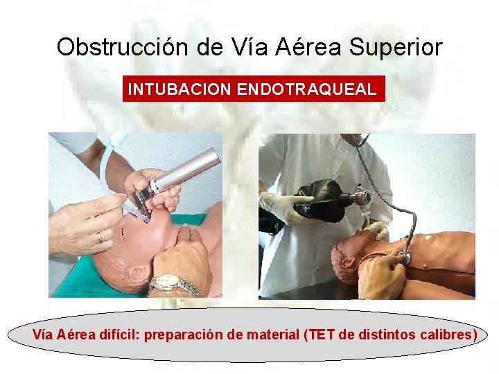 Obstrucción de Vía Aérea Superior INTUBACION ENDOTRAQUEAL Vía Aérea difícil: preparación de material (TET