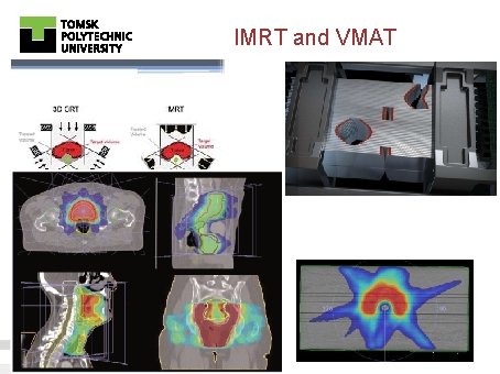 IMRT and VMAT 40 