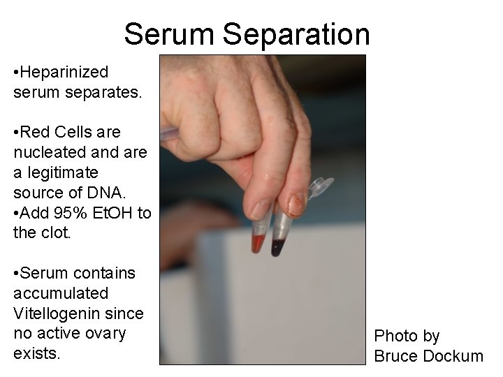 Serum Separation • Heparinized serum separates. • Red Cells are nucleated and are a