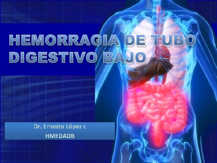 HEMORRAGIA DE TUBO DIGESTIVO BAJO Dr. Ernesto López c HMEDADB 