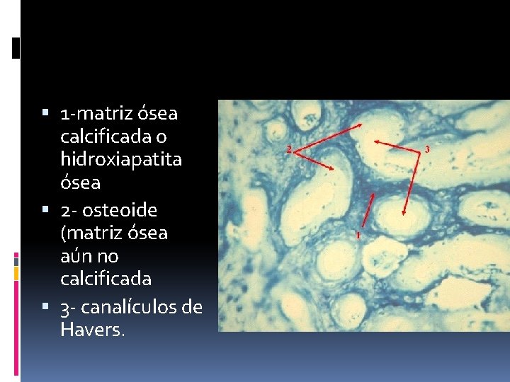 1 -matriz ósea calcificada o hidroxiapatita ósea 2 - osteoide (matriz ósea aún 1 -matriz ósea calcificada o hidroxiapatita ósea 2 - osteoide (matriz ósea aún