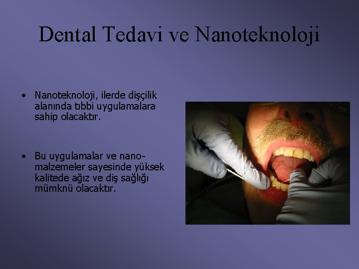 Dental Tedavi ve Nanoteknoloji • Nanoteknoloji, ilerde dişçilik alanında tıbbi uygulamalara sahip olacaktır. •