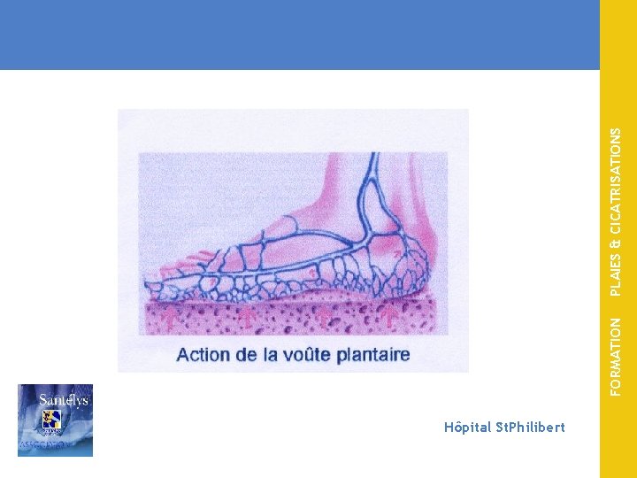 Hôpital St. Philibert FORMATION PLAIES & CICATRISATIONS 