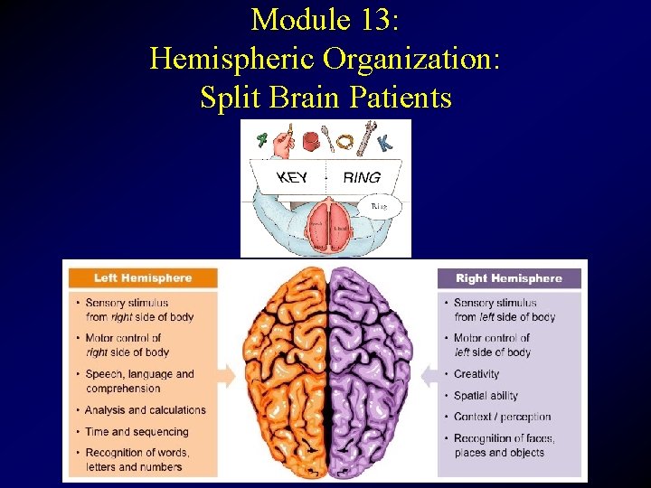 Module 13: Hemispheric Organization: Split Brain Patients 