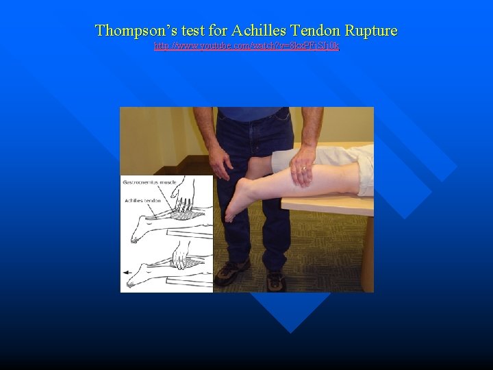 Thompson’s test for Achilles Tendon Rupture http: //www. youtube. com/watch? v=8 kx. PFj. SJj