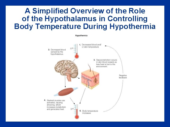 A Simplified Overview of the Role of the Hypothalamus in Controlling Body Temperature During A Simplified Overview of the Role of the Hypothalamus in Controlling Body Temperature During