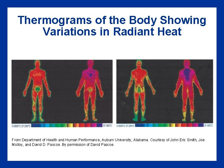 Thermograms of the Body Showing Variations in Radiant Heat From Department of Health and Thermograms of the Body Showing Variations in Radiant Heat From Department of Health and