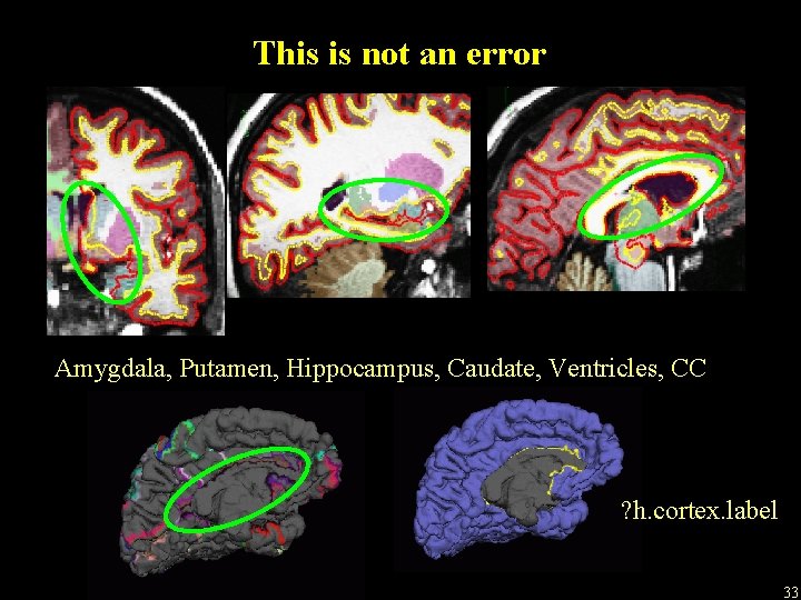 This is not an error Amygdala, Putamen, Hippocampus, Caudate, Ventricles, CC ? h. cortex.