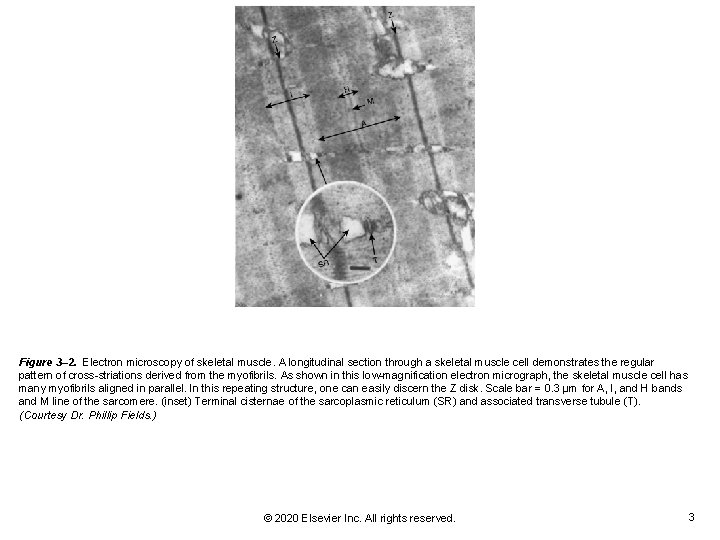 Figure 3– 2. Electron microscopy of skeletal muscle. A longitudinal section through a skeletal Figure 3– 2. Electron microscopy of skeletal muscle. A longitudinal section through a skeletal