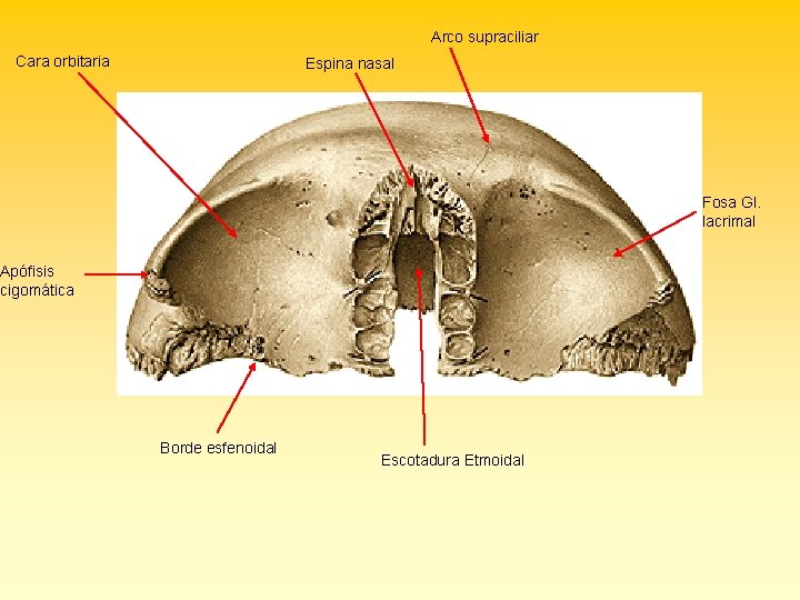 Arco supraciliar Cara orbitaria Espina nasal Fosa Gl. lacrimal Apófisis cigomática Borde esfenoidal Escotadura