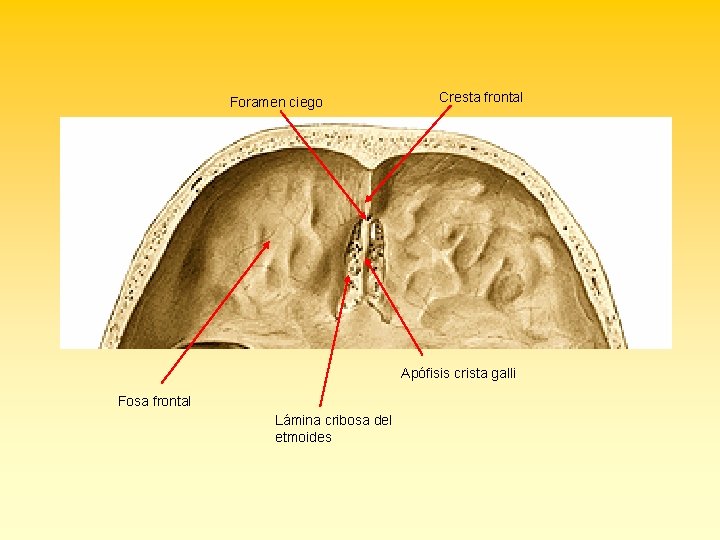 Foramen ciego Cresta frontal Apófisis crista galli Fosa frontal Lámina cribosa del etmoides 
