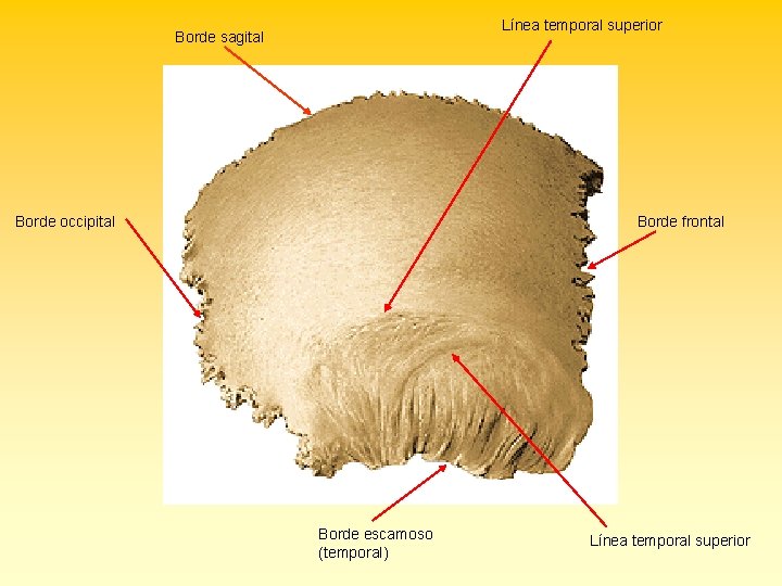 Línea temporal superior Borde sagital Borde occipital Borde frontal Borde escamoso (temporal) Línea temporal