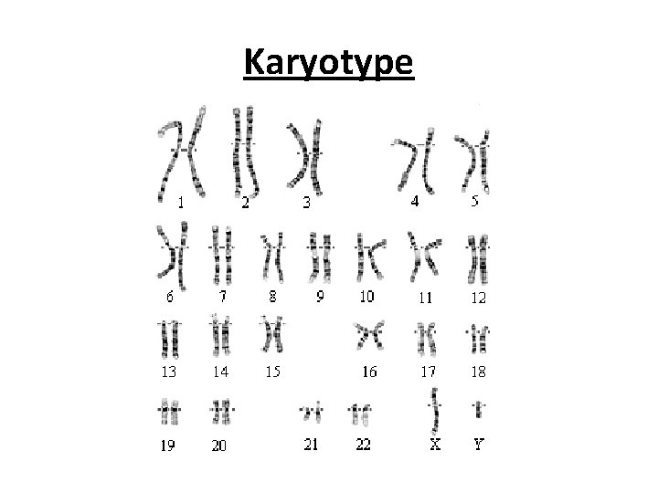 Karyotype 